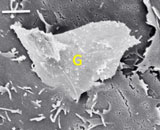 Зазубренный графен может разрушать клеточные мембраны