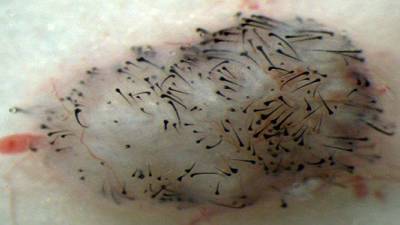 Открыт способ выращивания волос с помощью стволовых клеток