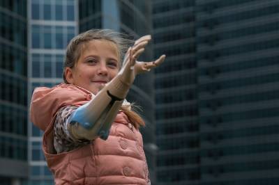 В России открылась первая программа психологической помощи детям с протезами рук