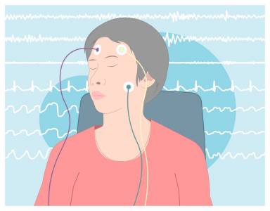 Ученые разработали искусственный интеллект, способный диагностировать бессудорожную эпилепсию по результатам ЭЭГ
