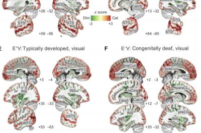 Science Advances: Мозг формирует эмоции независимо от органов чувств