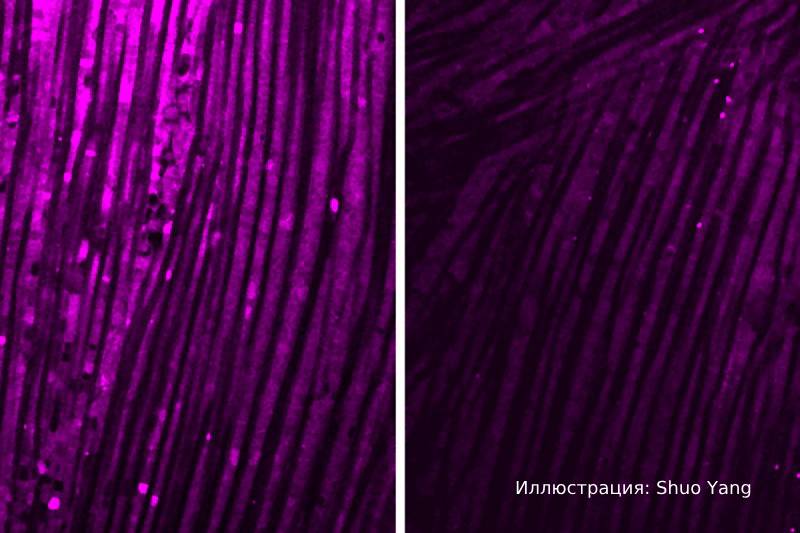 Science Immunology: Воспаление мозга вызывает мышечную слабость после инфекций