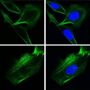 Белок-шаперон GRP78 играет ключевую роль в метастазах раковых клеток