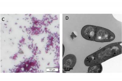 PLOS Patogens: Туберкулез, как и наземные формы жизни, вышел из воды